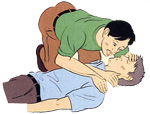 1.意識の確認