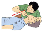 3.気道の確保